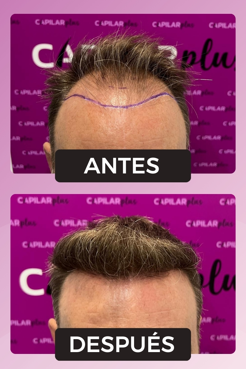 CLINICA CAPILAR SEVILLA