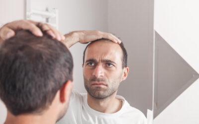 10 preguntas que debes saber sobre el injerto capilar