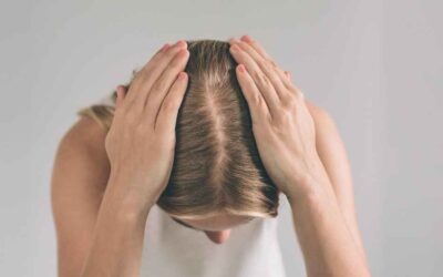 Tricotilomanía: 7 técnicas para dejar de arrancarse el cabello